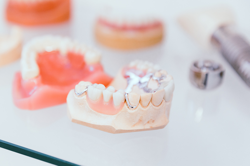 Zahnersatz: Zahnkronen, Zahnbrücken und herausnehmbarer Zahnersatz
